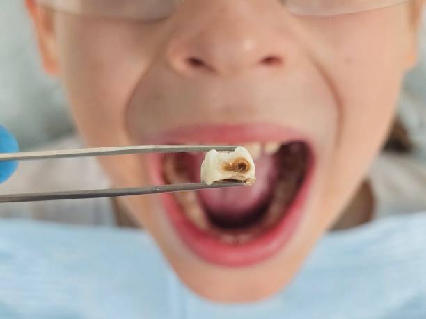 Best Emergency Treatment for Toothache in Chadwicks, NY